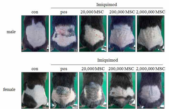 효과적인 건선유사 피부염증의 억제를 위한 MSC 세포수 결정