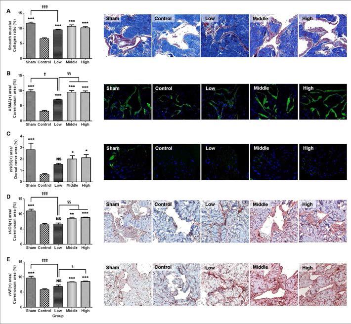 (A) Masson Trichrome 염색법을 이용한 Collagen 대비 Muscle의 비율 (좌) 및 대표적 이미지 (우). (B) 면역형광법을 이용한 ASMA의 함량 (좌) 및 대표적 이미지 (우). (C) nNOS의 함량 (좌) 및 대표적 이미지 (우). (D) 면역조직화학법을 이용한 eNOS의 함량 (좌) 및 대표적 이미지 (우). (E) vWF의 함량 (좌) 및 대표적 이미지 (우)