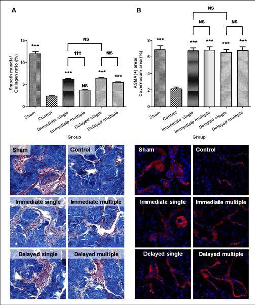 Masson Trichrome 염색법을 이용한 Collagen 대비 Muscle의 비율 (좌상) 및 대표적 이미지 (좌하). 면역형광법을 이용한 ASMA의 함량 (우상) 및 대표적 이미지 (우하)