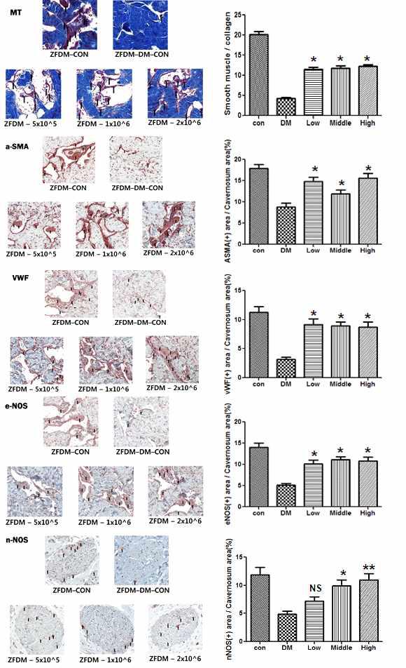 Masson Trichrome 염색법을 이용한 Collagen 대비 Muscle의 비율 및 대표적 이미지(1). 면역조직화학법을 이용한 ASMA의 함량 및 대표적 이미지(2). 면역조직화학법을 이용한 VWF의 함량 및 대표적 이미지(3). 면역조직화학법을 이용한 eNOS의 함량 및 대표적 이미지(4). 면역조직화학법을 이용한 nNOS의 함량 및 대표적 이미지 (5)