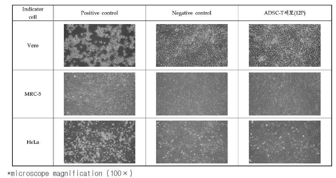 Photographs of Vero, MRC-5, and HeLa cells (cytopathic effect after 7 days cultivation).