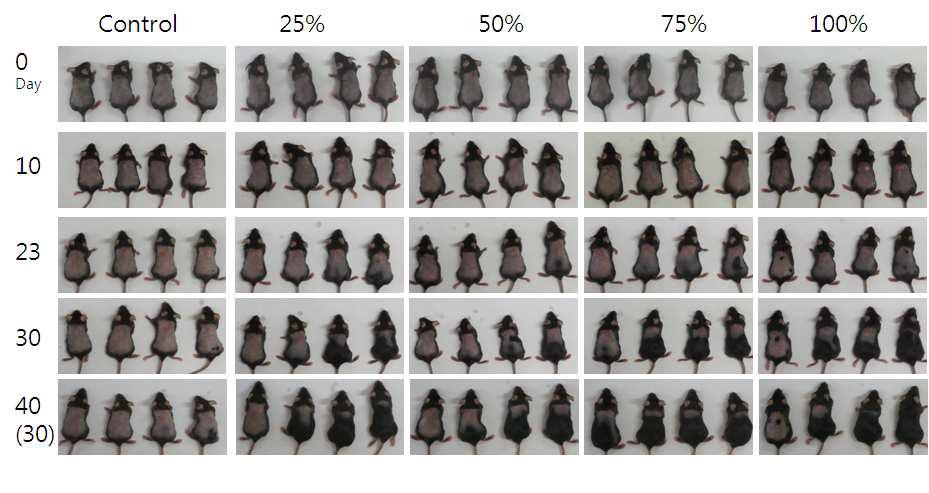 Hair growth-promoting effect of conditioned medium of ADSC-T