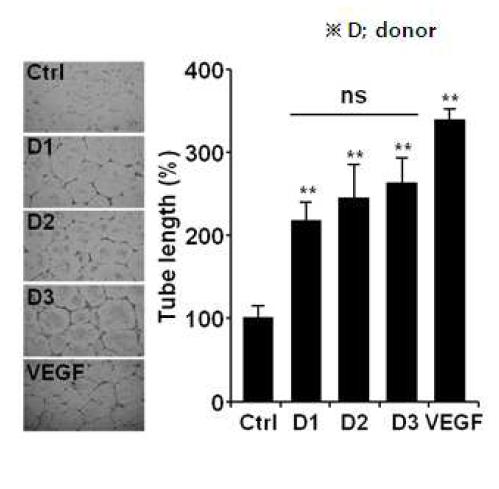 MSC-conditioned medium에 의한 HUVECs in vitro tube formation 유도 효과