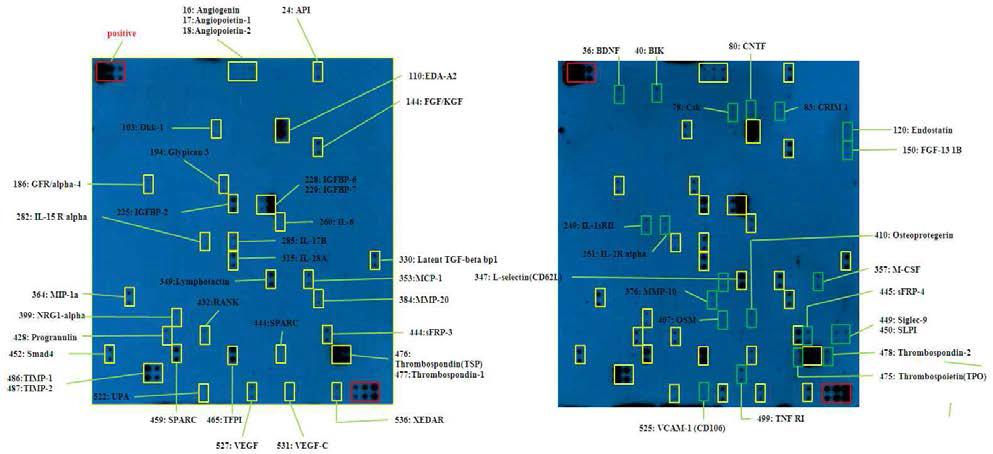 MSC-conditioned medium antibody array 결과