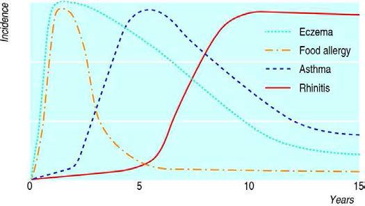 Incidence of different types of atopy by age
