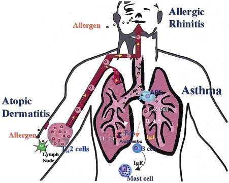 Skin sensitization after allergen exposure leads to systemic immune response