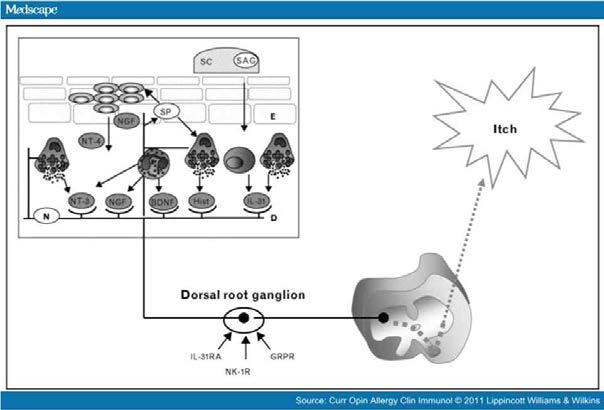 Pathophysiology of itch and new treatment