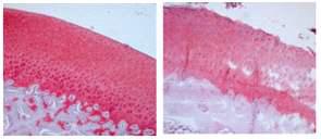 Histological analysis of articular cartilage by H&E staining from the rats with intra-articular injection with normal saline (control) or 0.05 ml of 4 mg/ml collagenase solution (CIA)
