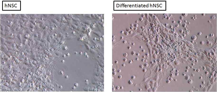인간 신경 줄기세포의 미분화, 분화 시의 세포 형태 사진