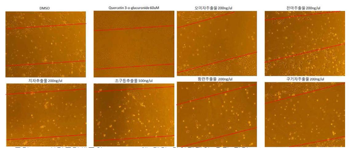 신경줄기세포의 migration에 대한 한약제제의 효과 관련 migration assay