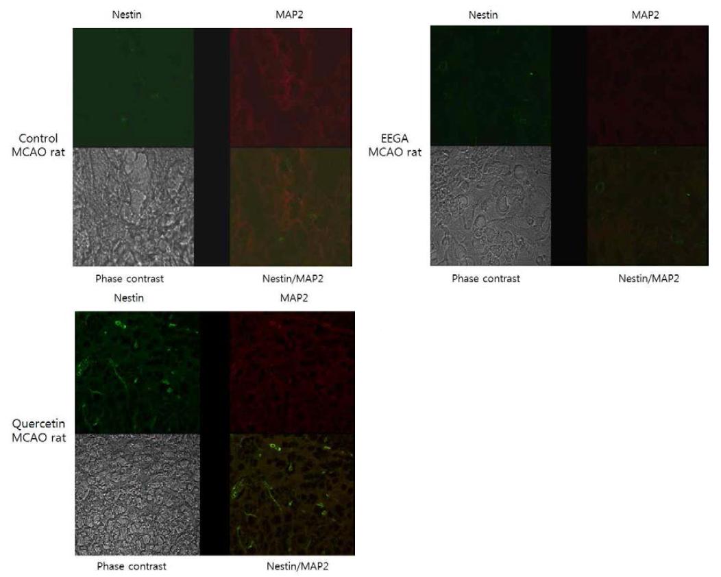 뇌졸중 모델 쥐 뇌의 Nestin/MAP2 면역형광염색 결과