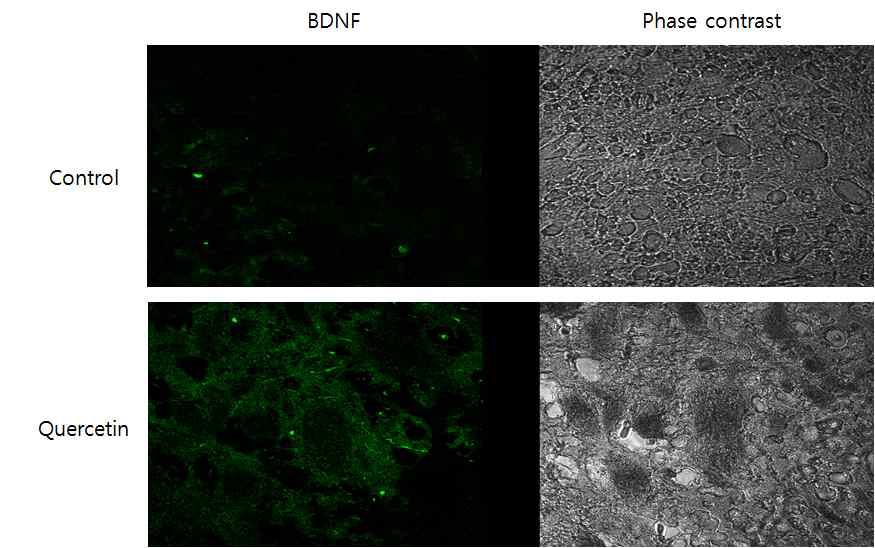 BDNF 면역형광염색 결과