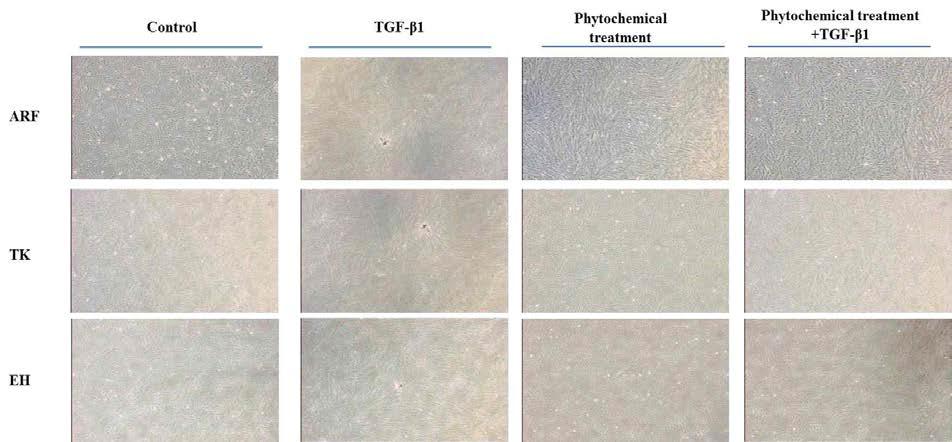 The inhibition effect of Oriental medicine in Nodule formation induced by TGF-β1 solution