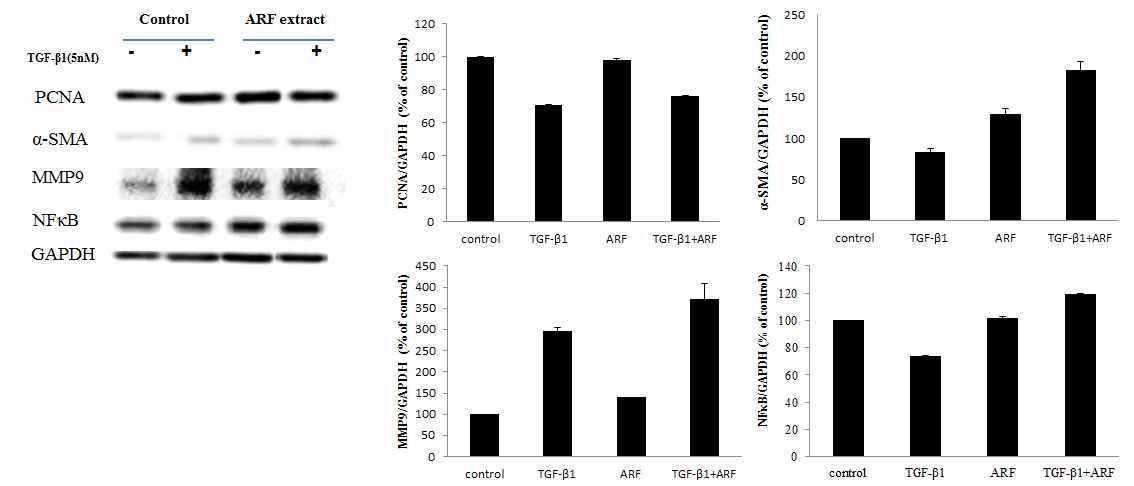 The inhibition effect of Oriental medicine in inflammation, proteolysis of extracellular matrix and migration of leukocyte by TGF-β1 solution