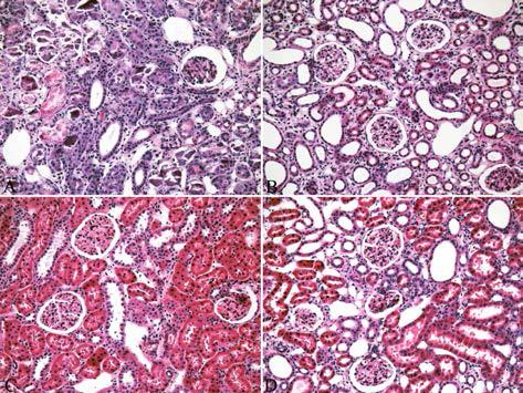 The ameliorate effect of Oriental medicine in Body weight and kidney weight in UUO-induced chronic renal failure