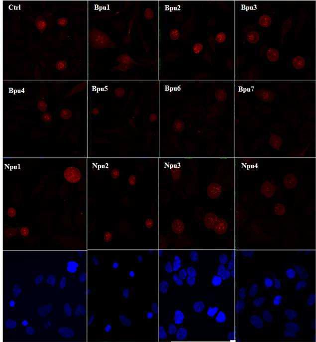 Immunostaining for treatment of Plk1 inhibitors after double thymidine release in Hela cell