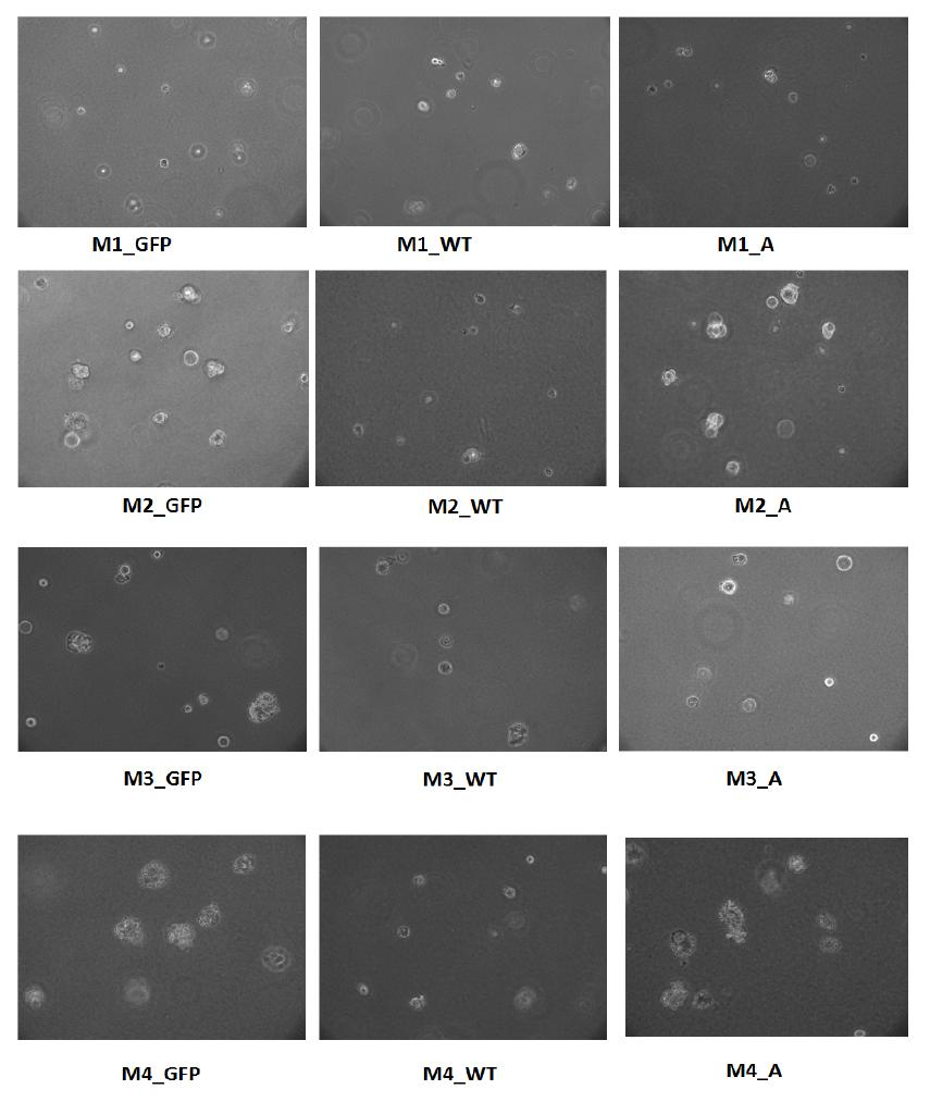 Soft agar assay for inhibition of colony formation by PBIP in MCF10A cells