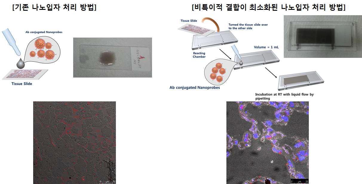 생검 조직에 기존 나노입자 처리 방법과 비특이적 결합이 최소화된 나노입자 처리 방법으로 처리된 생검 시료의 공초점레이저주사현미경 (Confocal Laser Scanning Microscopy,CLSM) 이미지. 항체와 결합된 나노입자는 붉은 색으로 표현됨.