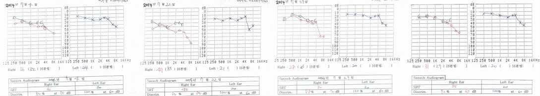 청력개선회복에 따른 양군간의 비교