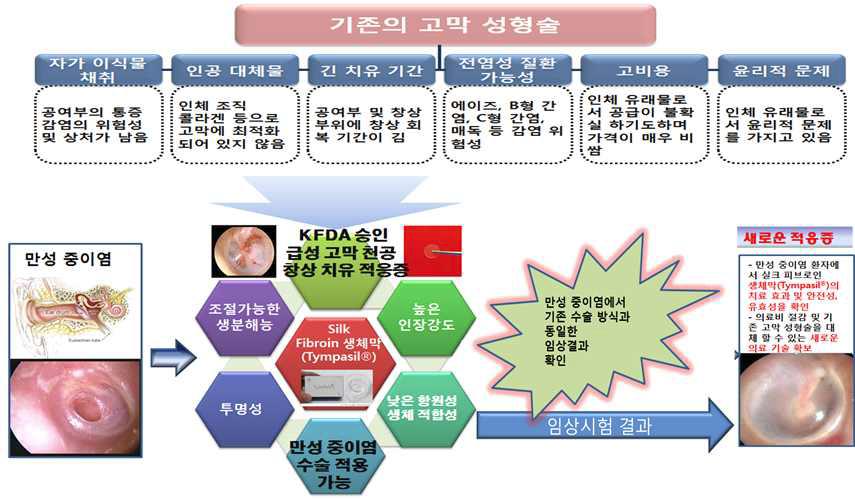 만성 중이염 환자에서의 팀파실에 의한 고막 천공 치료의 장점들