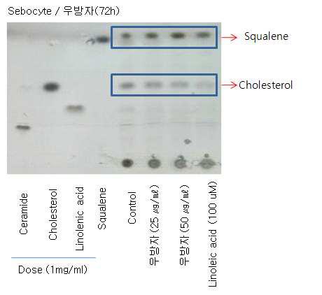 우방자 처리 후 HPTLC를 통한 지질 성분 분석
