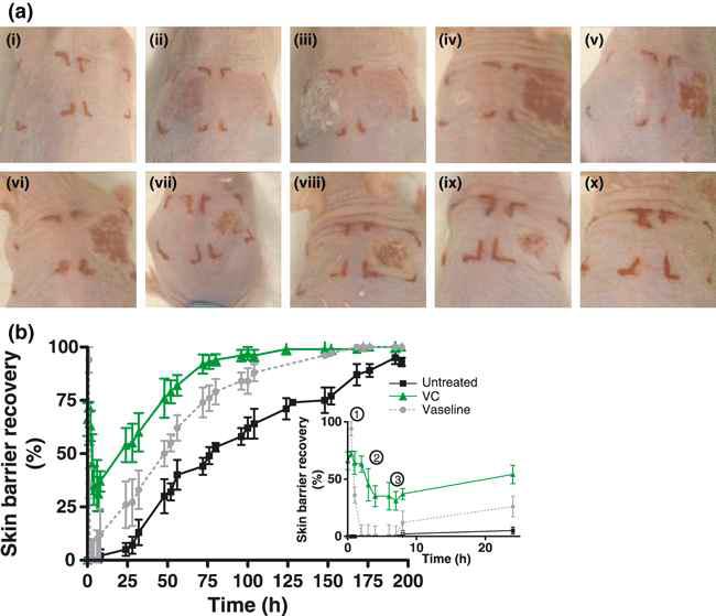 손상된 피부에서 Vernix caseosa(태아기름막)의 효과