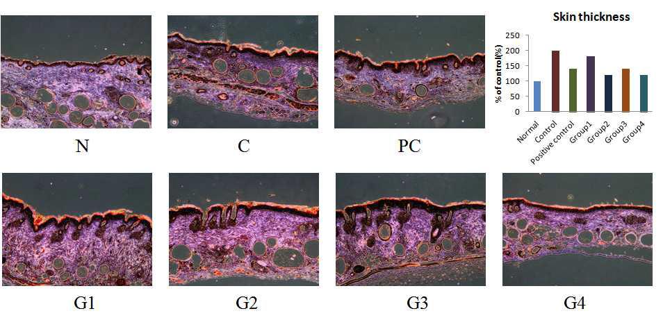UVB로 광노화를 유도한 무모쥐 피부 표피층에서의 두께 측정