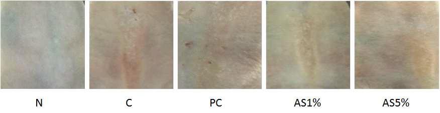 UVB로 광노화를 유도한 무모쥐에서 알로에신이 피부 표면 변화에 미치는 영향