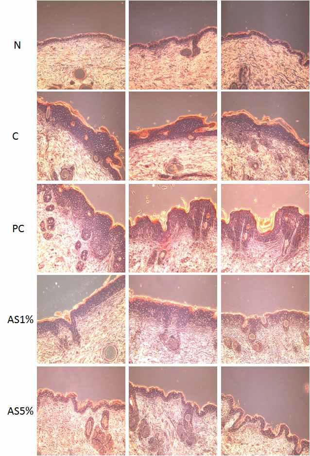 UVB로 광노화를 유도한 무모쥐에서 알로에신 도포에 따른 피부 표피층 두께변화에 미치는 영향