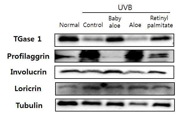 UVB로 광노화를 유도한 무모쥐의 피부 표피층에서 알로에가 피부보습인자의 발현에 미치는 영향