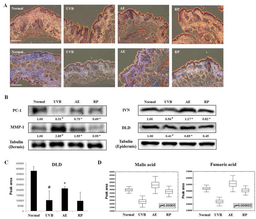 UVB로 광노화를 유도한 무모쥐에서의 노화 관련 인자 및 변화 측정