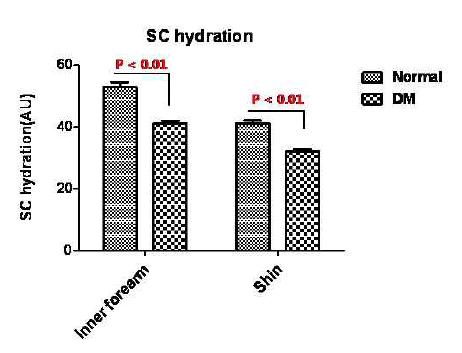 SC hydration in normal control vs DM patients