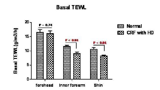 Basal TEWL in normal control vs CKD patients