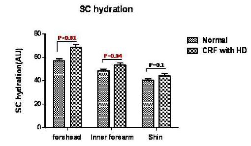 SC hydration in normal control vs CKD patients