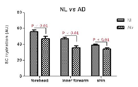 SC hydration in normal control vs AD patients