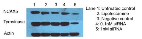 SLC24A5-siRNA의 transfection에 의한 melan-a 세포에서 SLC24A5와 tyrosinase의 발현량 감소