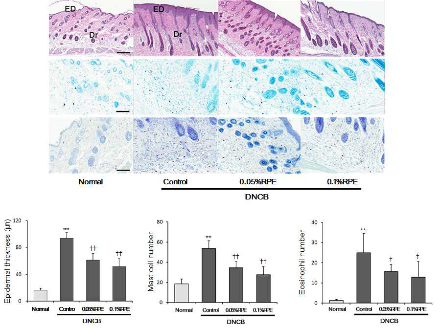 BALB/c 생쥐에서 DNCB 및 RPE 처치에 따른 피부의 조직학적 변화