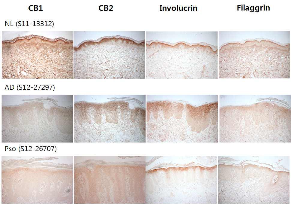 정상피부, 아토피, 건선 피부의 Cannabinoid receptor 1,2와 involucrin, filaggrin 염색 경향 비교 –1.