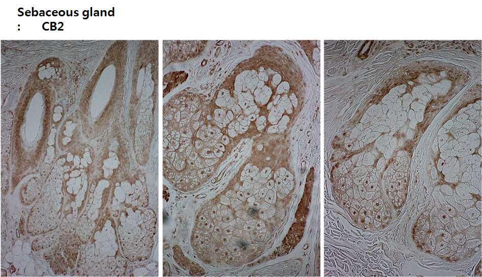 Sebaceous gland의 Cannabinoid receptor 2 발현 양상.