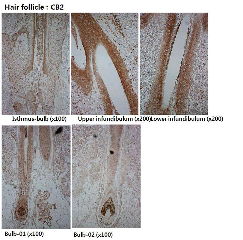 Hair follicle의 Cannabinoid receptor 2 발현 비교.