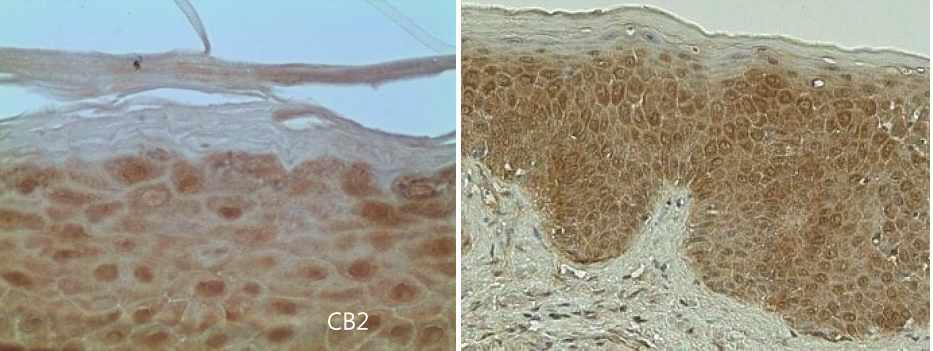 아토피피부염 동물모델에서 cannabinoid receptor 조절제의 항염증 효과