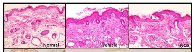Oxazolone을 이용한 아토피 피부염 동물 모델에서 Restomide (NOE)의 효과 관찰 결과.