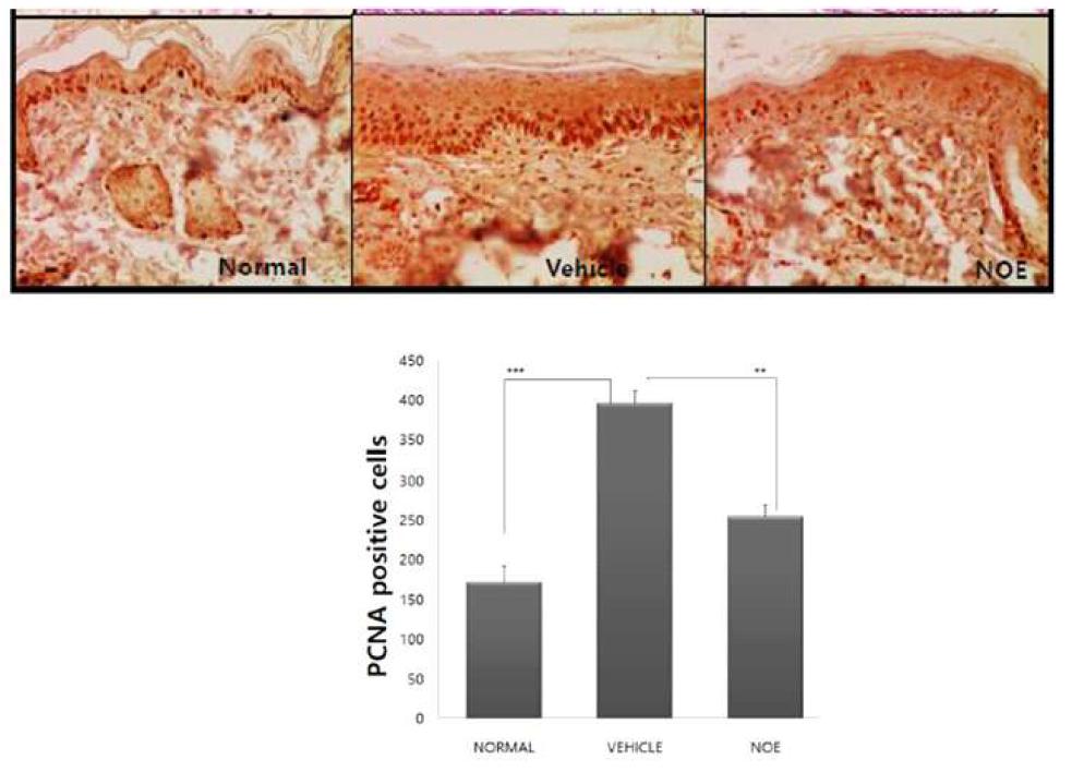 Oxazolone을 이용한 아토피 피부염 동물 모델에서 Restomide (NOE)의 효과 관찰 결과