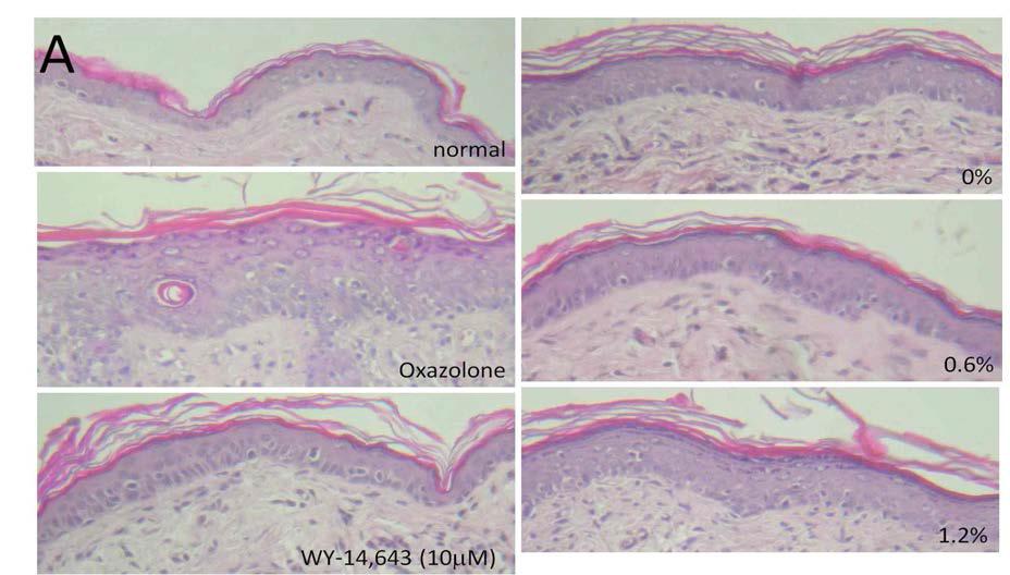 Oxazolone을 이용한 만성 피부염 모델에서 myristoyl/palmitoyl oxostearamide /arachamide MEA (PC-9S)에 의한 피부 두께의 변화.
