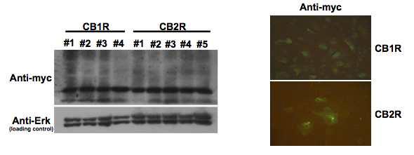 CB1R, CB2R 발현 여부 확인을 위한 Western blotting 결과와 immunohistochemical staining 결과