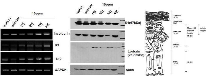 각질형성세포에서 한방처방에 의한 분화마커의 증가