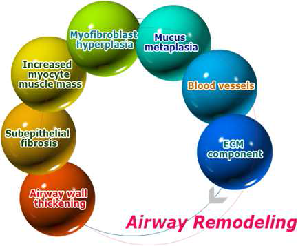 Airway remodeling(기도개형)