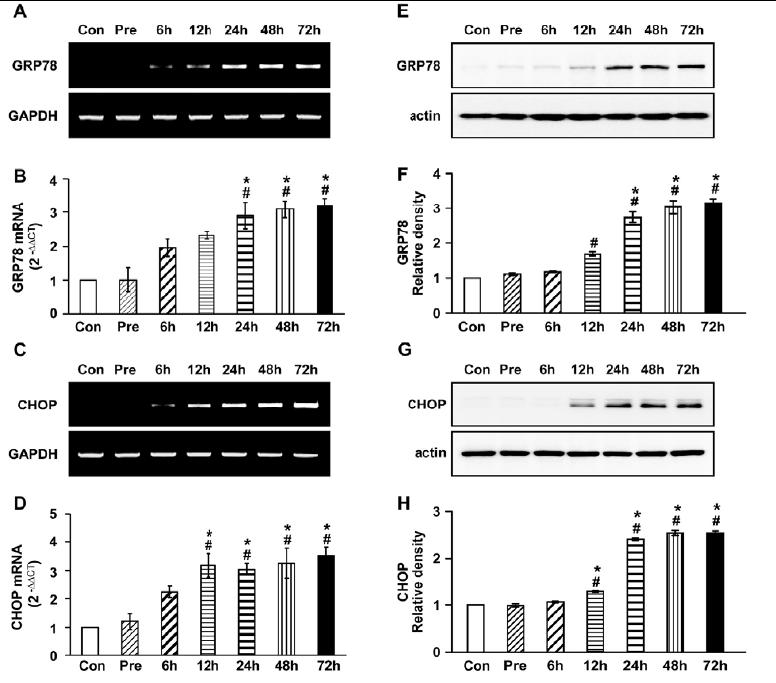 Expression of mRNA or protein for GRP78 and CHOP in lung tissues of OVA-LPS mice