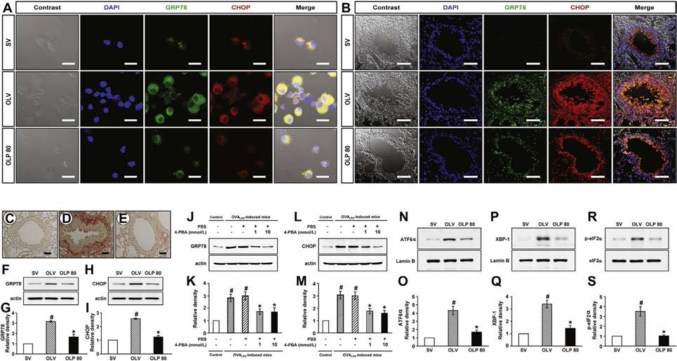 Effects of 4-PBA on ER Stress Markers and UPR-Related Proteins in OVA-LPS mice