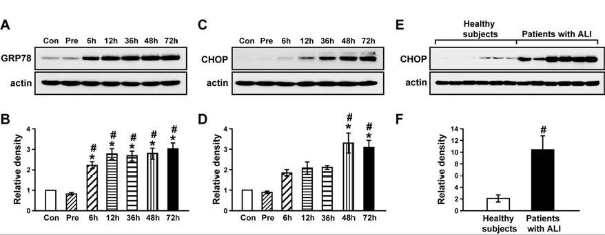 The levels of ER stress markers in lung tissues of LPS-treated mice and in PBMCs from patients with ALI and healthy subjects